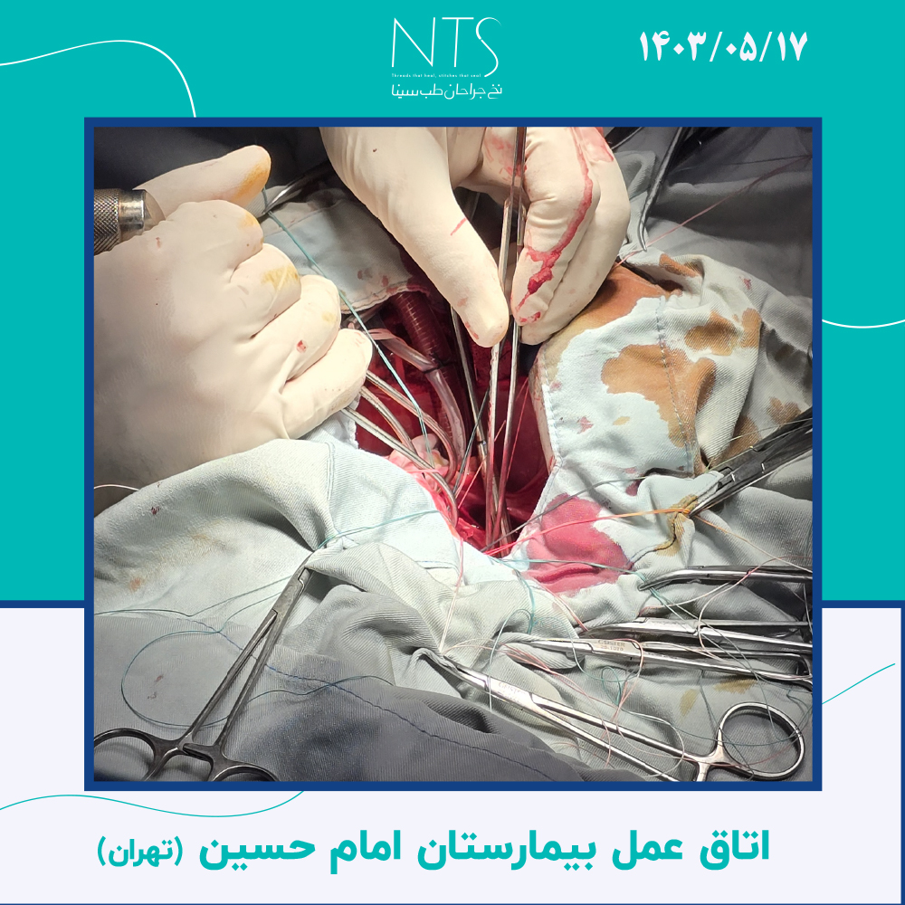 نخ پلی پروپیلن