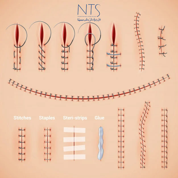 سمینار آموزش نخ و سوزن جراحی