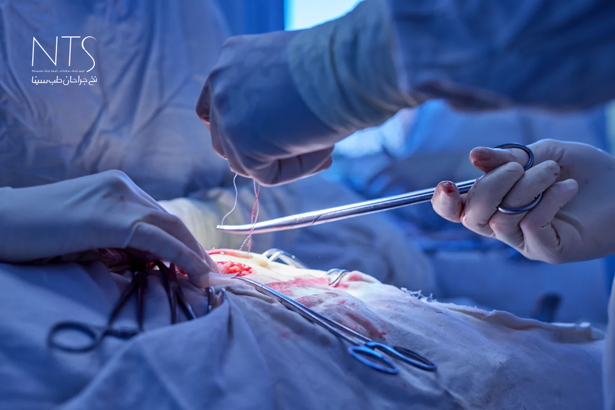 آموزش درون سازمانی جراحی عروق