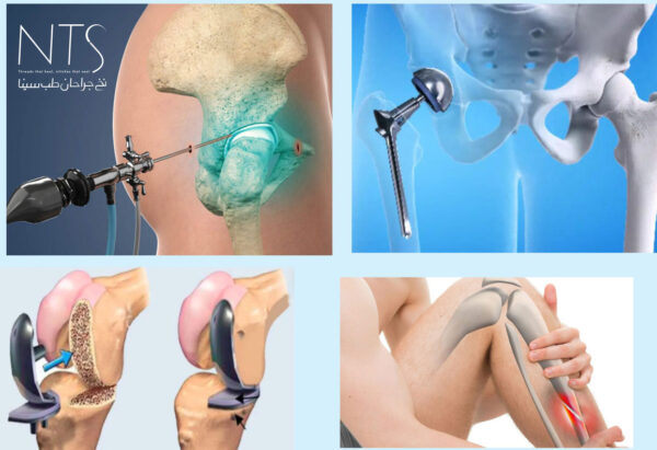 جراحی-ارتوپدی-0