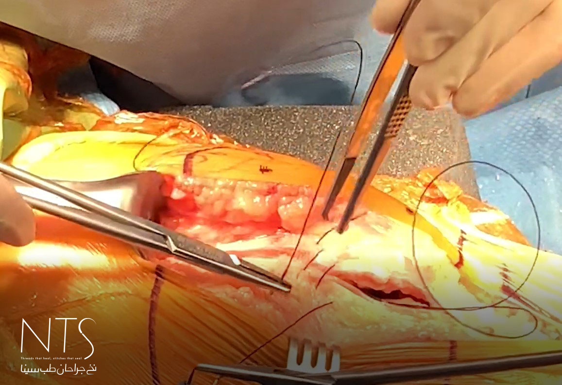 جراحی ارتوپدی